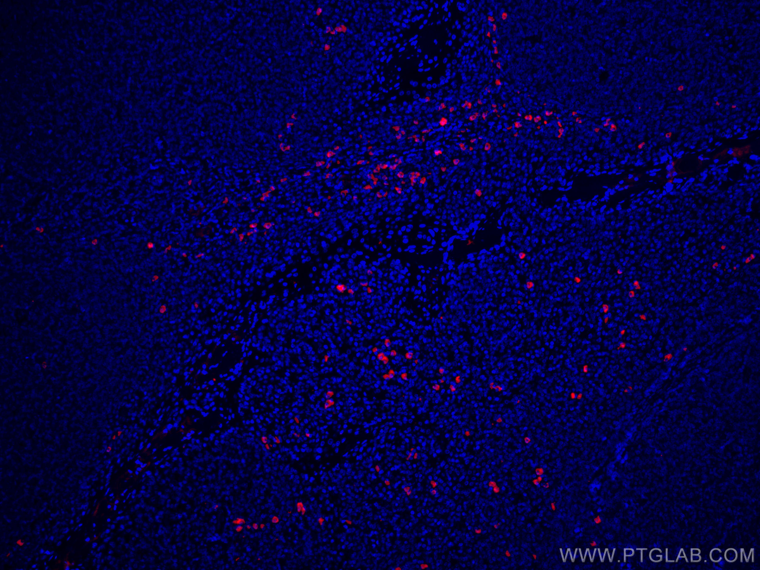 Immunofluorescence (IF) / fluorescent staining of human tonsillitis tissue using CoraLite®594-conjugated Human IgG4 Monoclonal anti (CL594-66408)