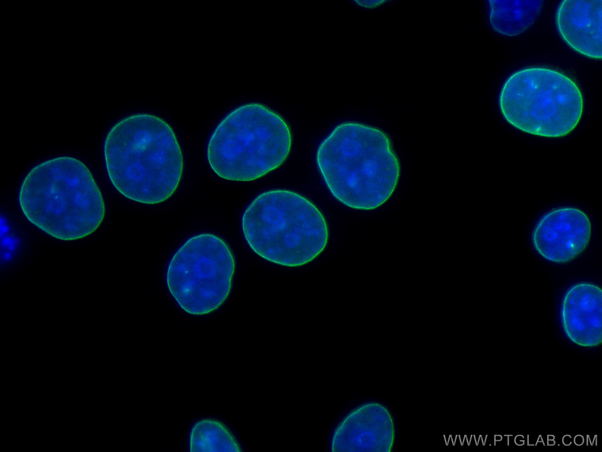 Immunofluorescence (IF) / fluorescent staining of HeLa cells using CoraLite® Plus 488-conjugated Heavy chain of Rabbi (CL488-66467)