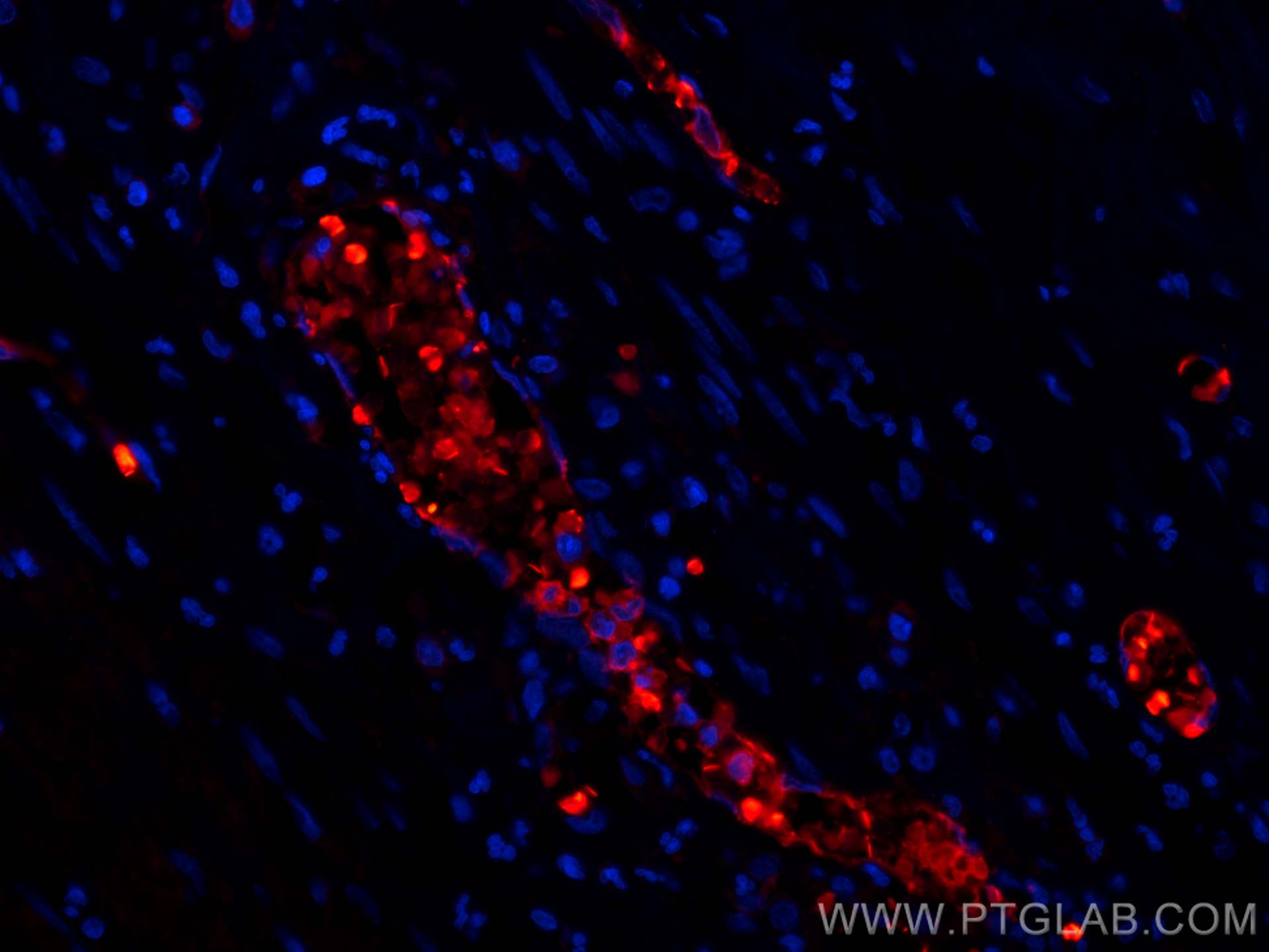 Immunofluorescence (IF) / fluorescent staining of human appendicitis tissue using CoraLite®594-conjugated Hemoglobin Alpha Polyclona (CL594-14537)