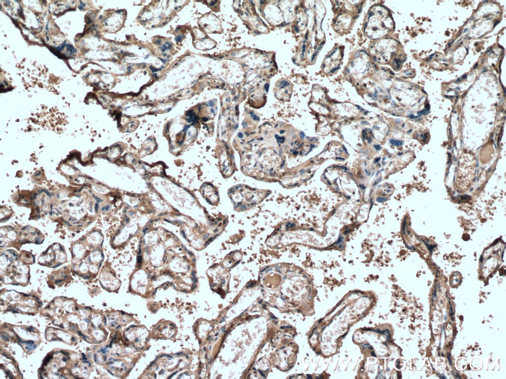 Hemopexin