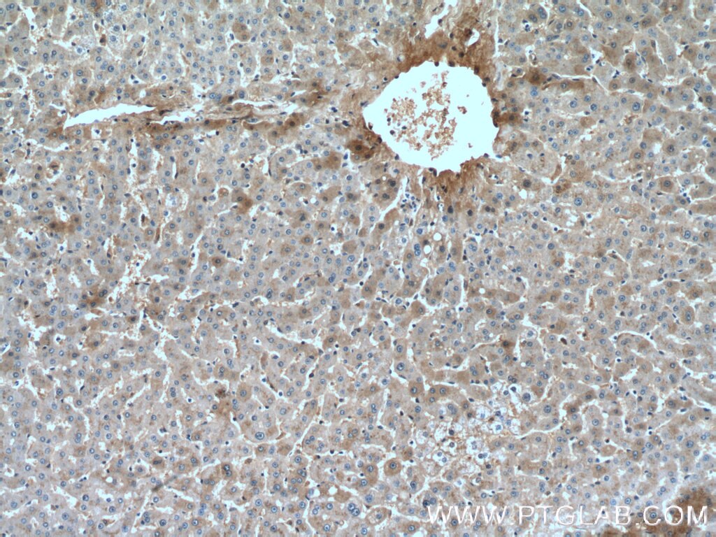 Immunohistochemistry (IHC) staining of human liver tissue using Hemopexin Monoclonal antibody (66479-1-Ig)
