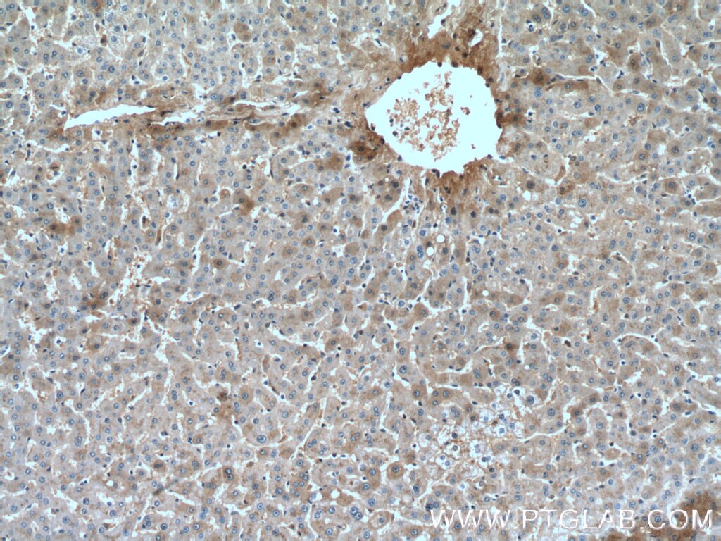 Immunohistochemistry (IHC) staining of human liver tissue using Hemopexin Monoclonal antibody (66479-1-Ig)