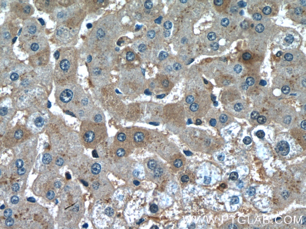Immunohistochemistry (IHC) staining of human liver tissue using Hemopexin Monoclonal antibody (66479-1-Ig)