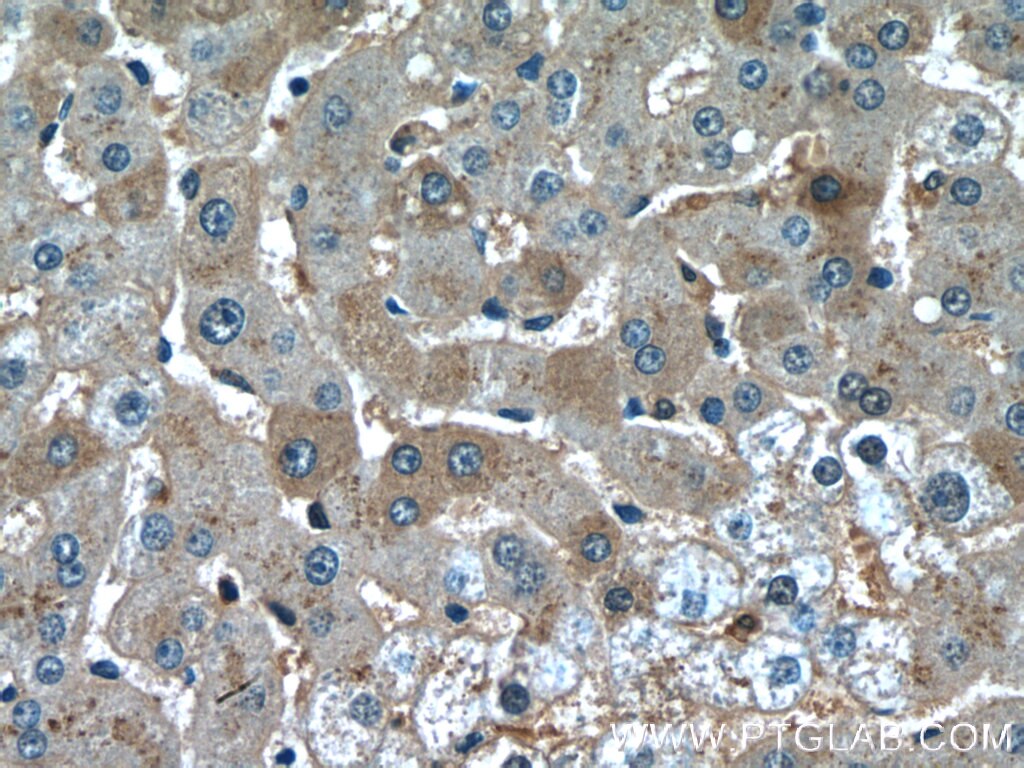 IHC staining of human liver using 66479-1-Ig