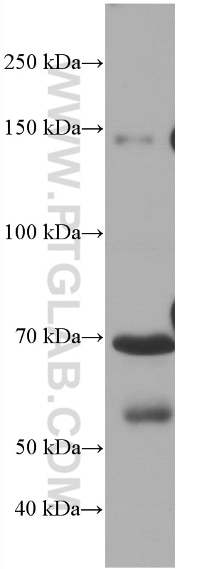 Western Blot (WB) analysis of pig plasma using Hemopexin Monoclonal antibody (66479-1-Ig)