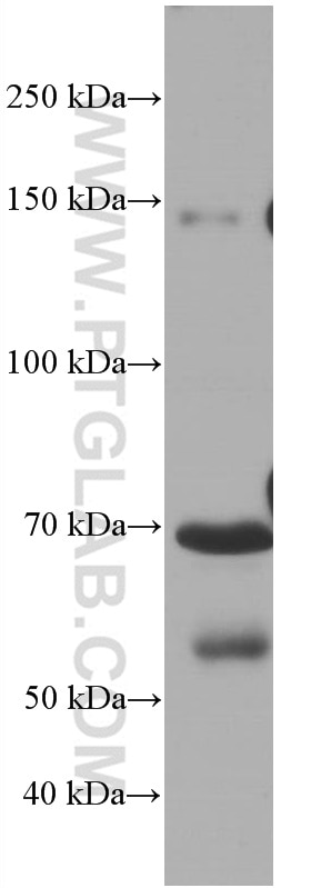 WB analysis of pig plasma using 66479-1-Ig