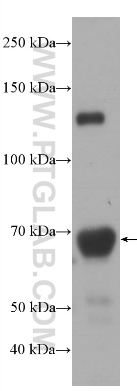 Western Blot (WB) analysis of rat serum using Hemopexin Monoclonal antibody (66479-1-Ig)
