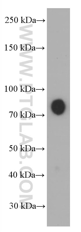 Western Blot (WB) analysis of human placenta tissue using Hemopexin Monoclonal antibody (66479-1-Ig)