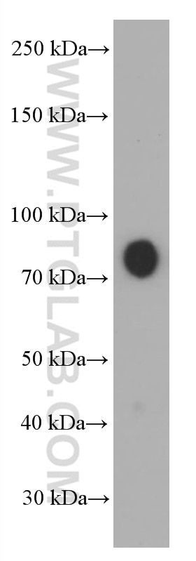 WB analysis of human placenta using 66479-1-Ig