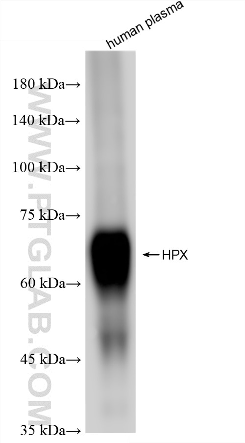 Western Blot (WB) analysis of human plasma using Hemopexin Recombinant antibody (86395-3-RR)