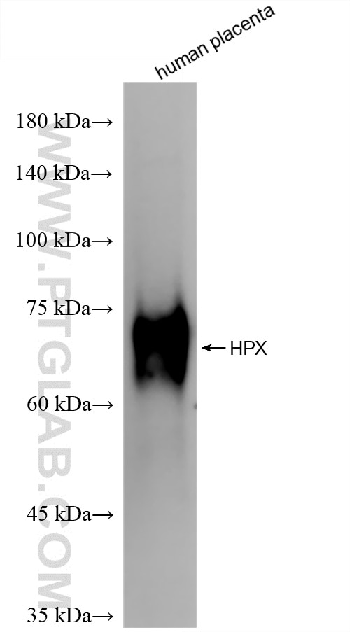 Western Blot (WB) analysis of human placenta tissue using Hemopexin Recombinant antibody (86395-3-RR)