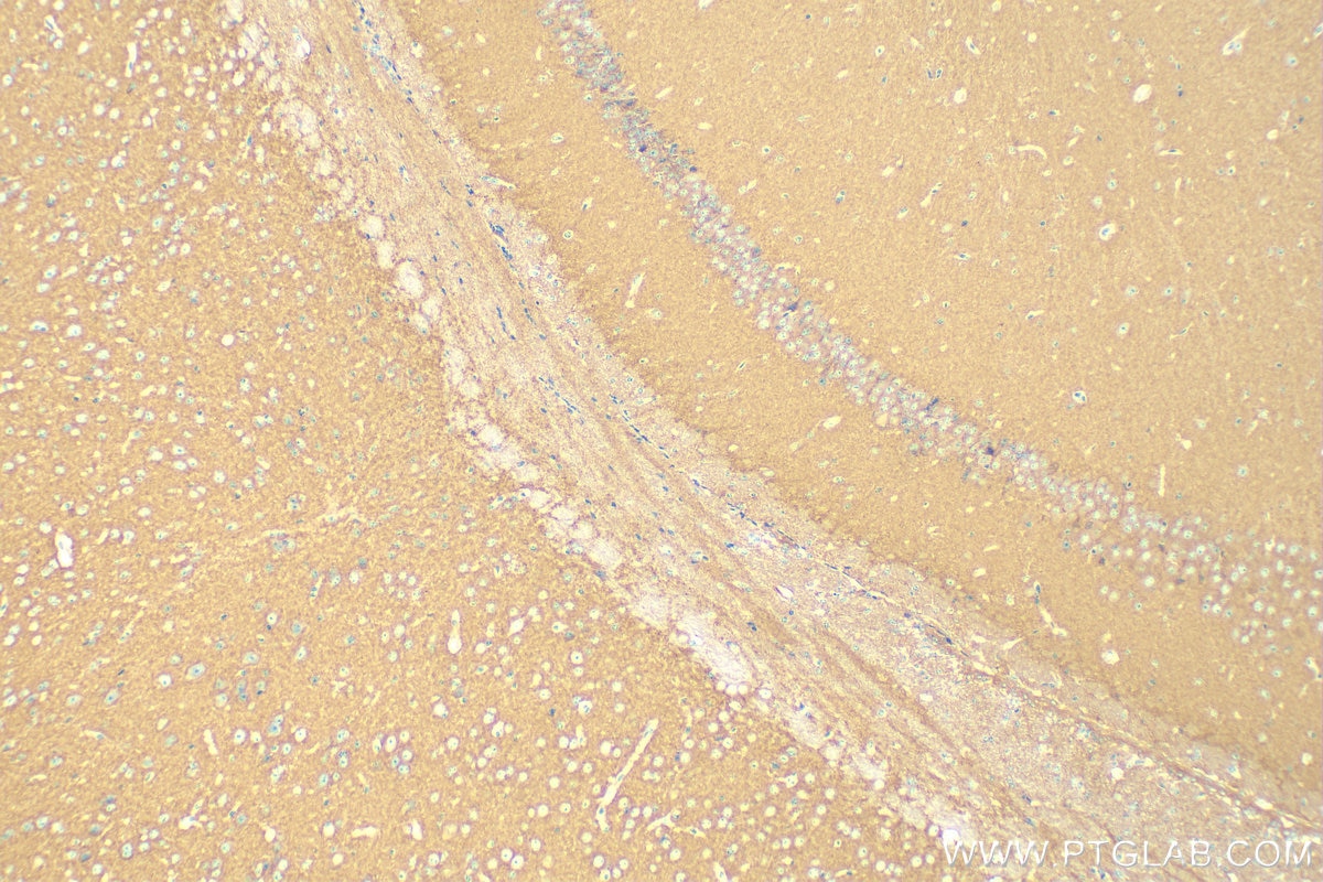 Immunohistochemistry (IHC) staining of mouse brain tissue using Hexokinase 1 Monoclonal antibody (68419-1-Ig)