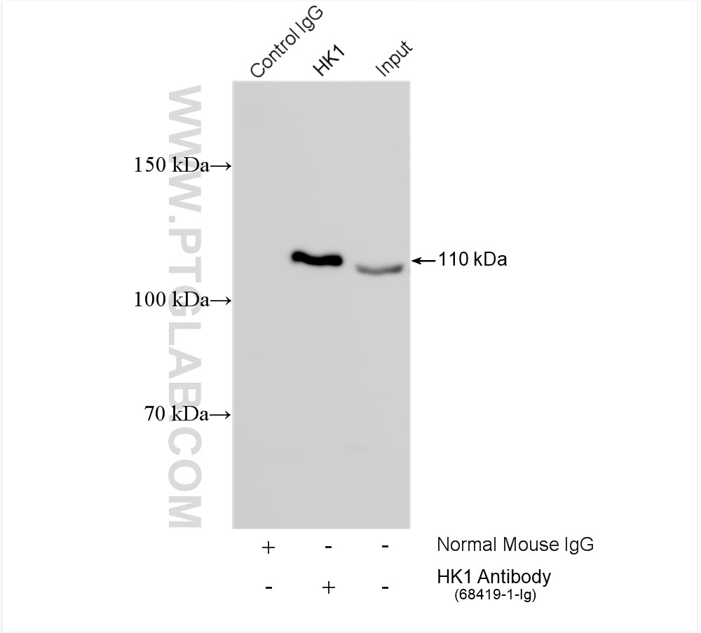 Immunoprecipitation (IP) experiment of HeLa cells using Hexokinase 1 Monoclonal antibody (68419-1-Ig)