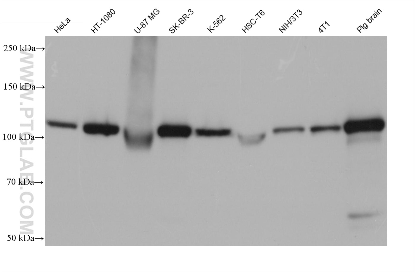 Western Blot (WB) analysis of various lysates using Hexokinase 1 Monoclonal antibody (68419-1-Ig)