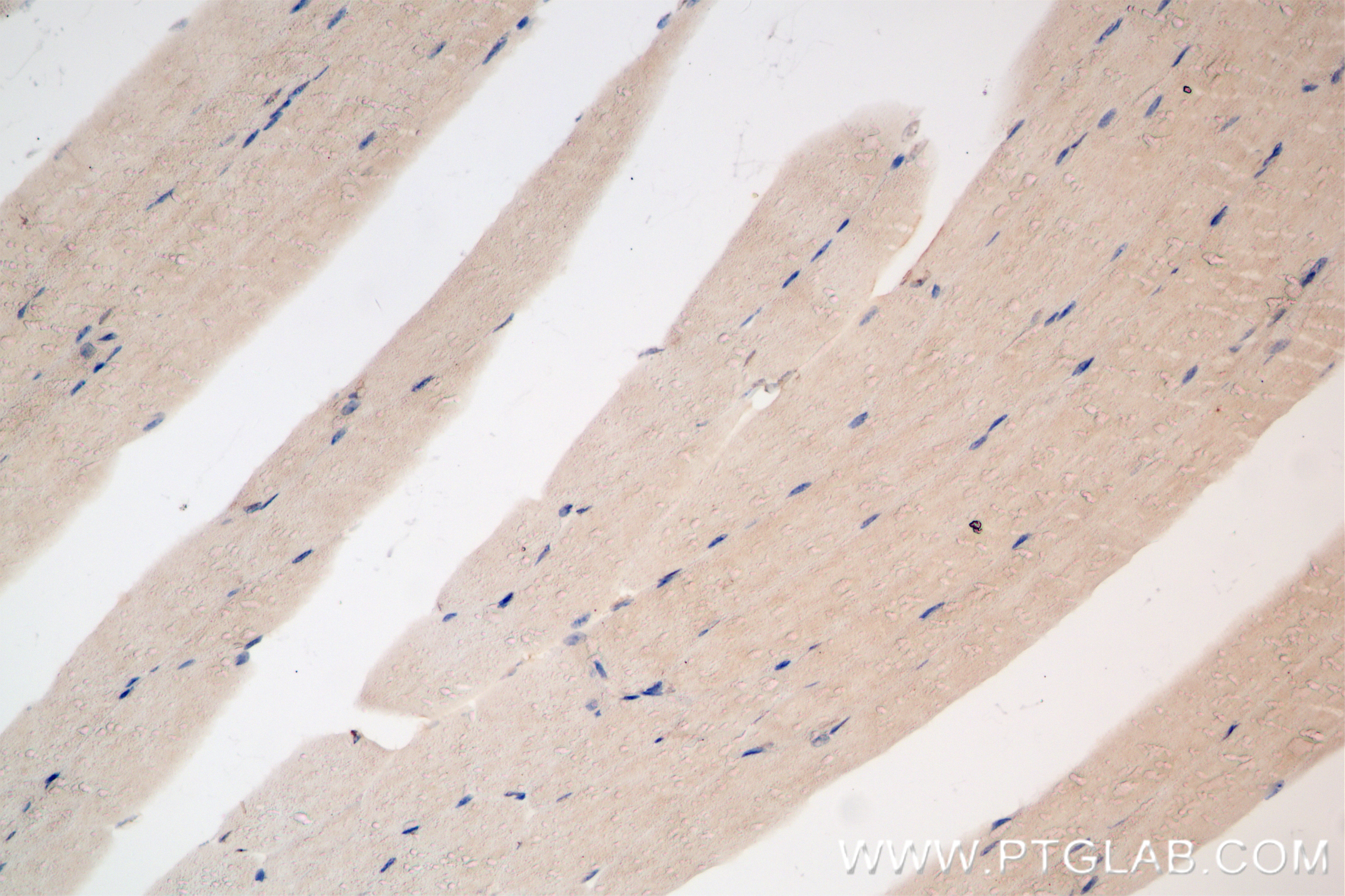 Immunohistochemistry (IHC) staining of mouse skeletal muscle tissue using Hexokinase 2 Recombinant antibody (85875-1-RR)