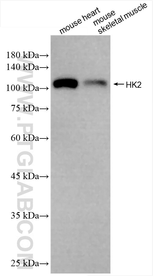 Western Blot (WB) analysis of various lysates using Hexokinase 2 Recombinant antibody (85875-1-RR)