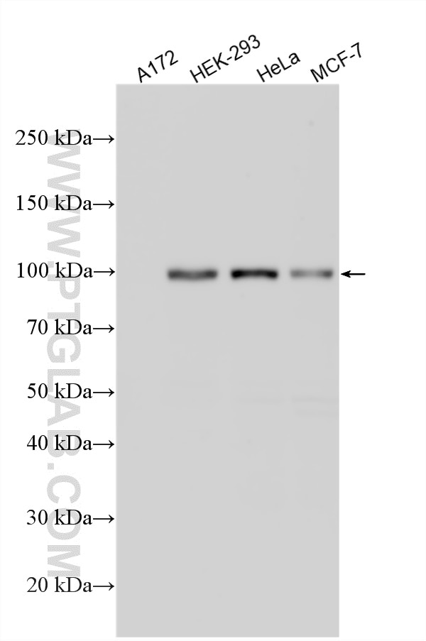 Western Blot (WB) analysis of various lysates using Hexokinase 2 Recombinant monoclonal antibody (85875-1-RR)