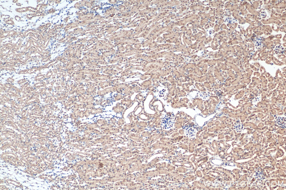 Immunohistochemistry (IHC) staining of mouse kidney tissue using Hif-1 alpha Recombinant monoclonal antibody (82989-6-RR)