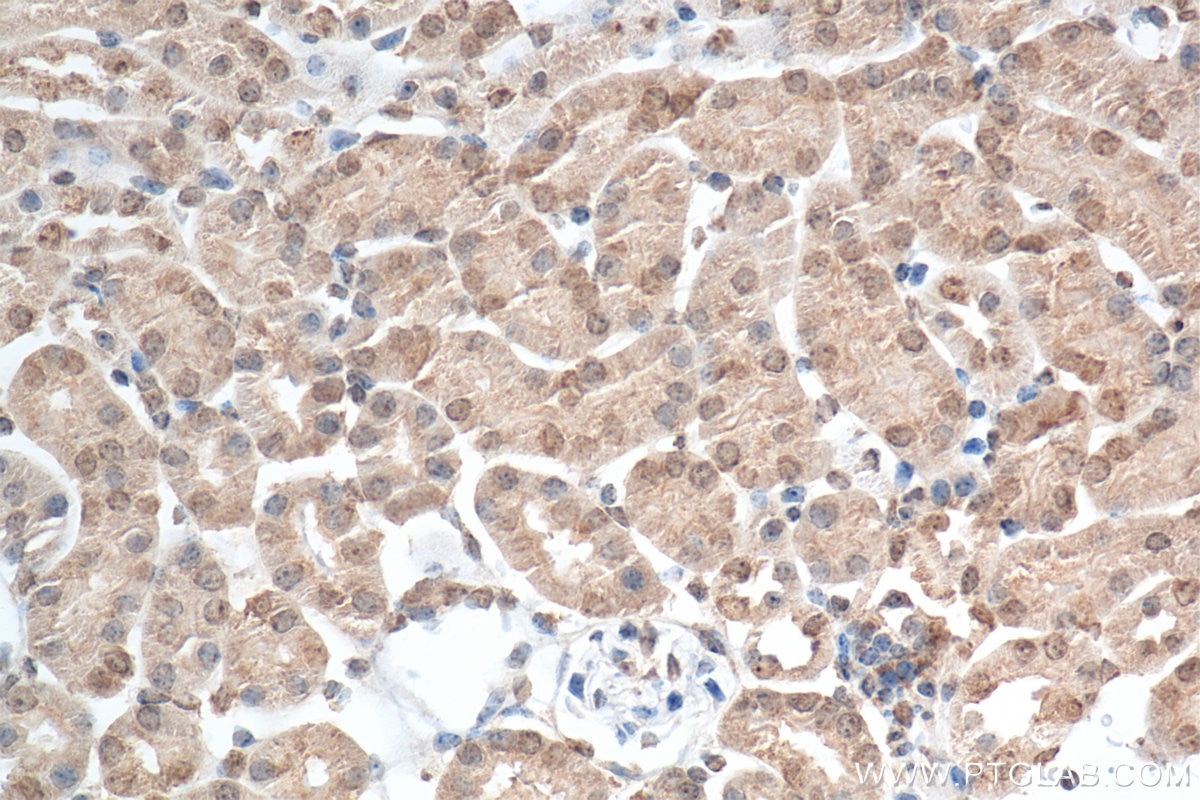 Immunohistochemistry (IHC) staining of mouse kidney tissue using Hif-1 alpha Recombinant monoclonal antibody (82989-6-RR)