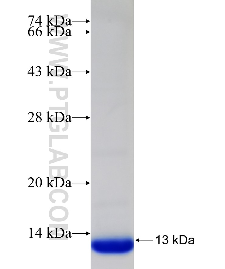His-Bacteria-Protein fusion protein Ag0050 SDS-PAGE