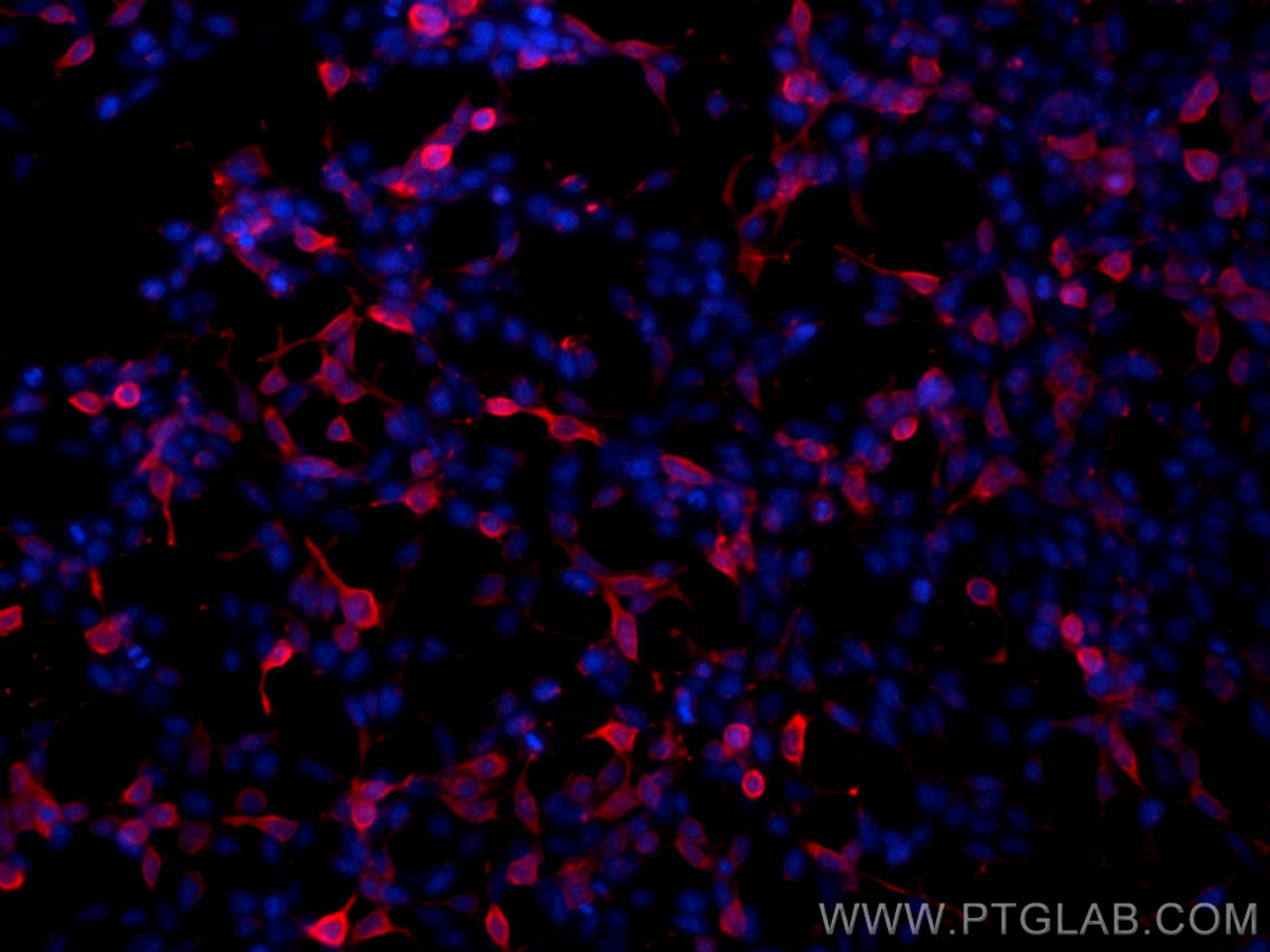 Immunofluorescence (IF) / fluorescent staining of Transfected HEK-293 cells using 6*His, His-Tag Monoclonal antibody (66005-1-Ig)