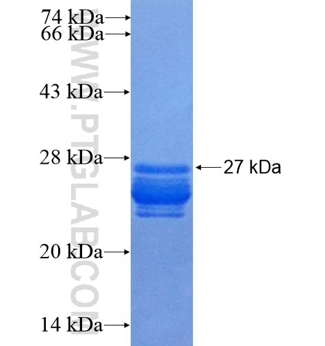 Histone H1.2 fusion protein Ag7503 SDS-PAGE