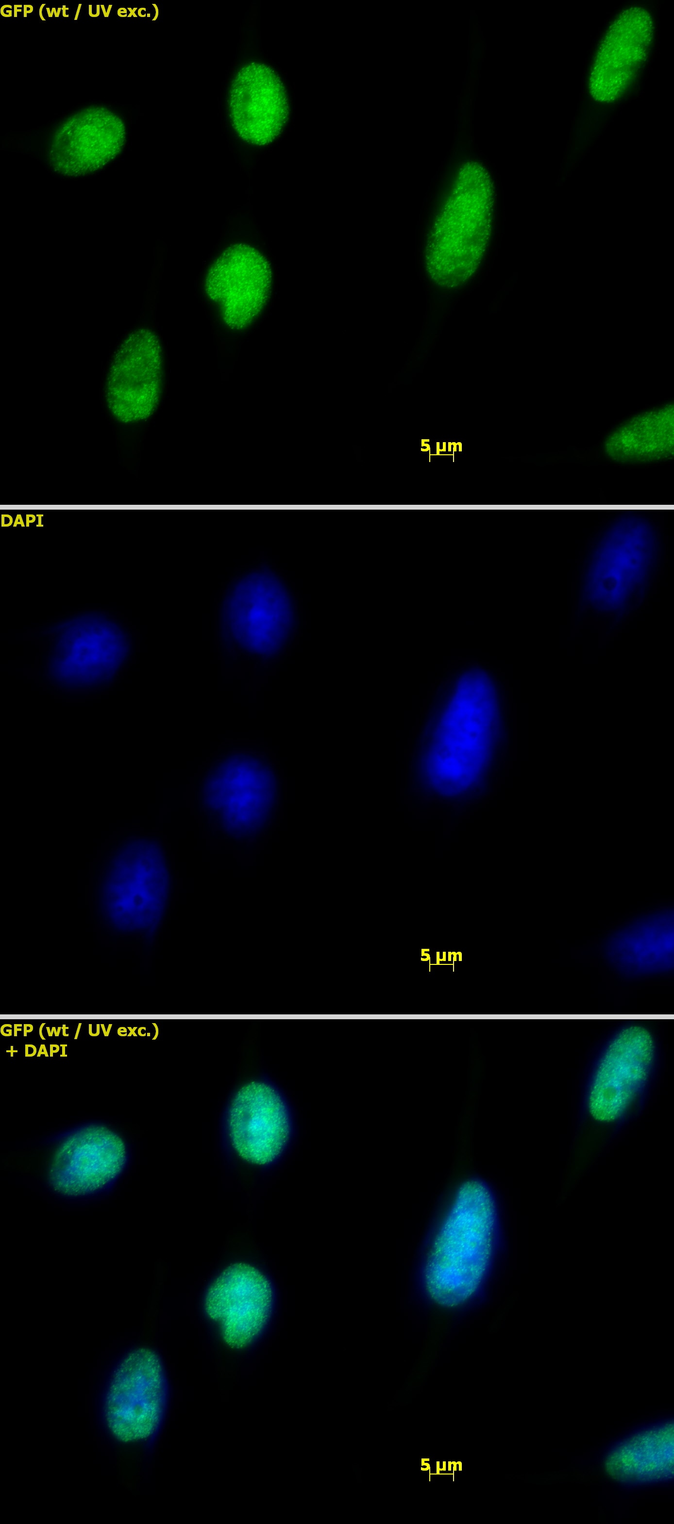 Histone H2AX antibody tested by immunofluorescence. Detection of Histone H2AX by immunofluorescence. HeLa cells were stained with Histone H2AX antibody at a dilution of 1:1,000. Top panel: Histone H2AX antibody staining. Middle panel: DAPI. Bottom panel: merge.