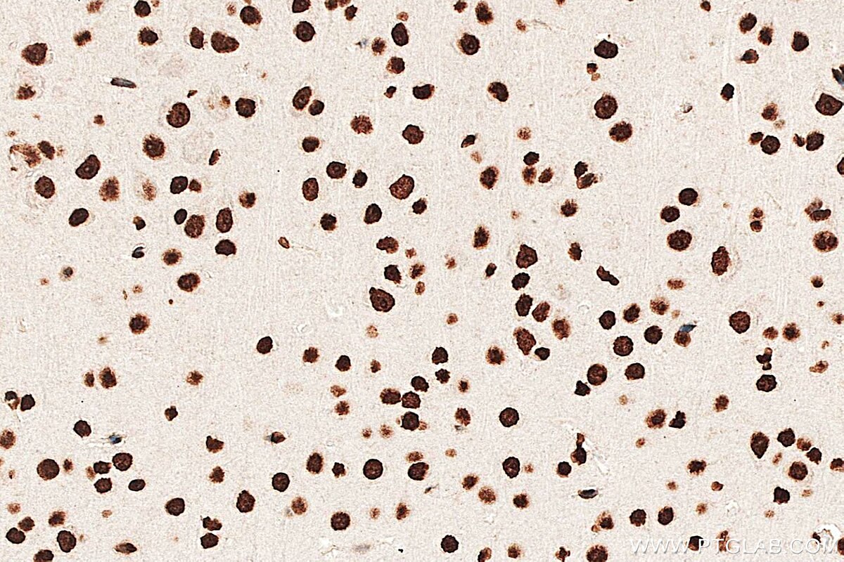 IHC staining of mouse brain using 33612-1-AP (same clone as 33612-1-PBS) Immunohistochemistry (IHC) staining of mouse brain tissue using Histone H2B Polyclonal antibody (33612-1-AP)