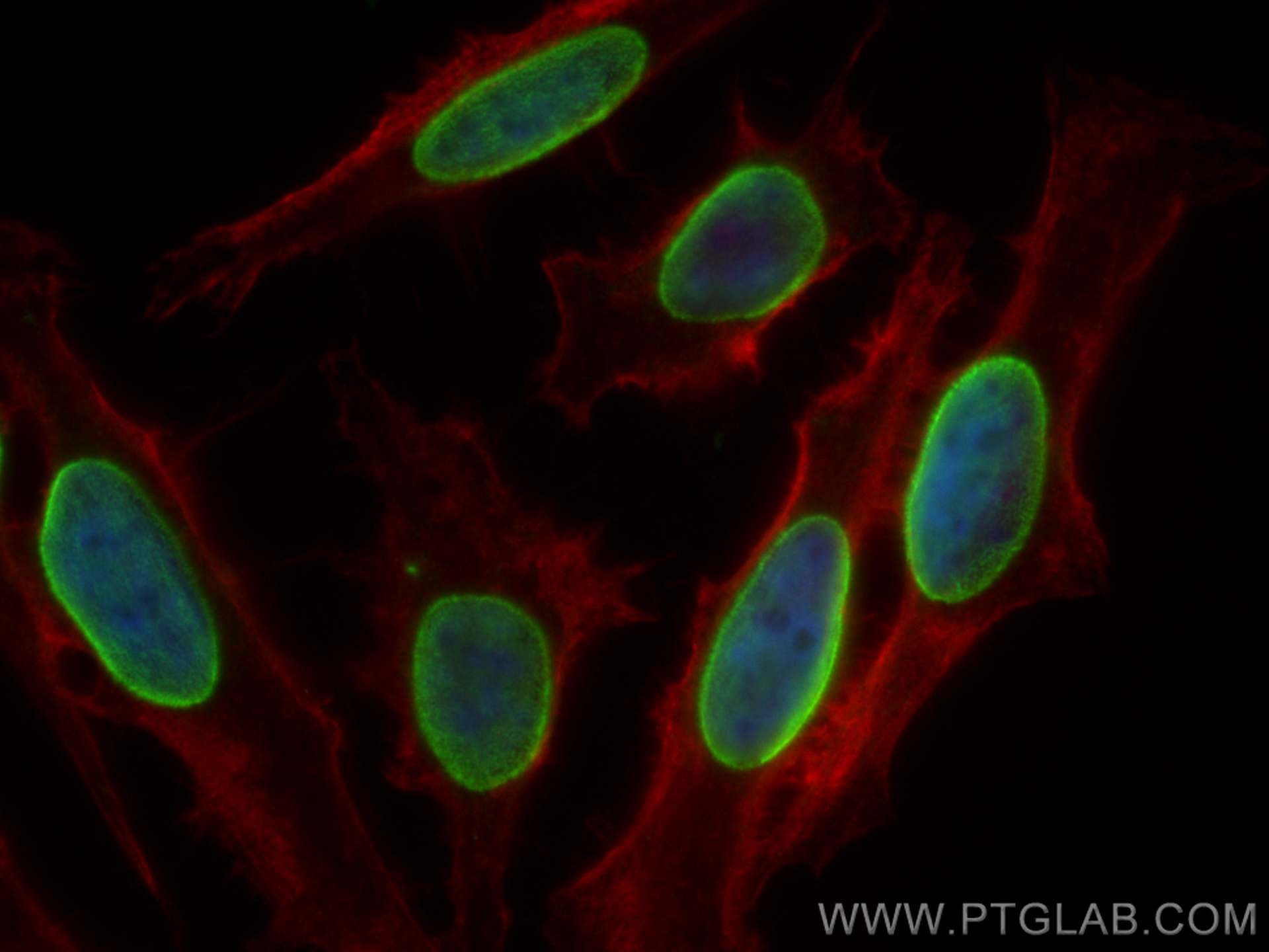 Immunofluorescence (IF) / fluorescent staining of HeLa cells using Histone H2B Monoclonal antibody (68393-1-Ig)