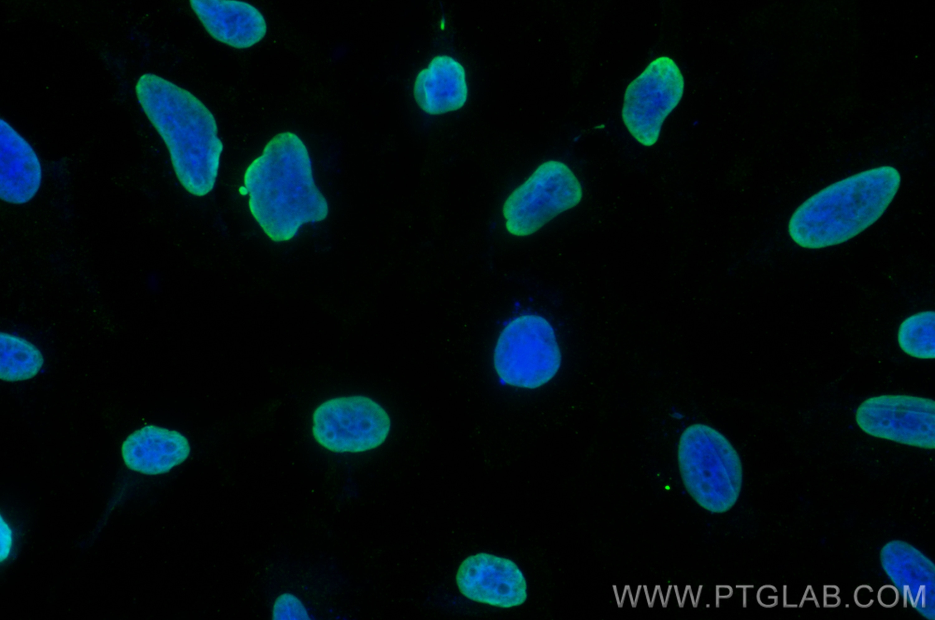 Immunofluorescence (IF) / fluorescent staining of HeLa cells using Histone H2B Monoclonal antibody (68393-1-Ig)