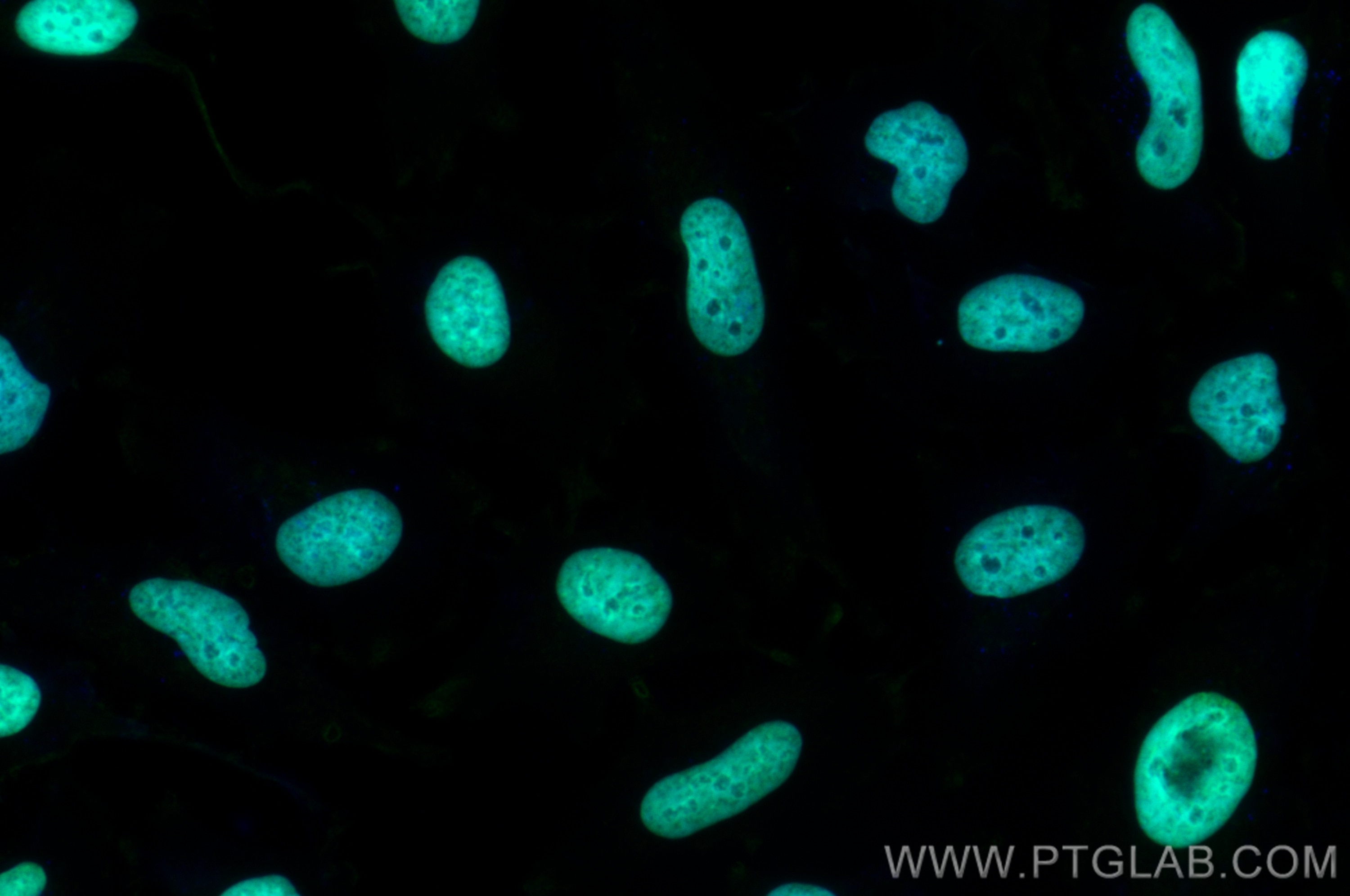 Immunofluorescence (IF) / fluorescent staining of HeLa cells using CoraLite® Plus 488-conjugated Histone H2B Monoclon (CL488-68393)