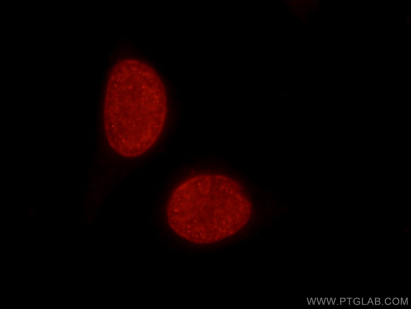 Immunofluorescence (IF) / fluorescent staining of HeLa cells using Histone-H3 Polyclonal antibody (17168-1-AP)