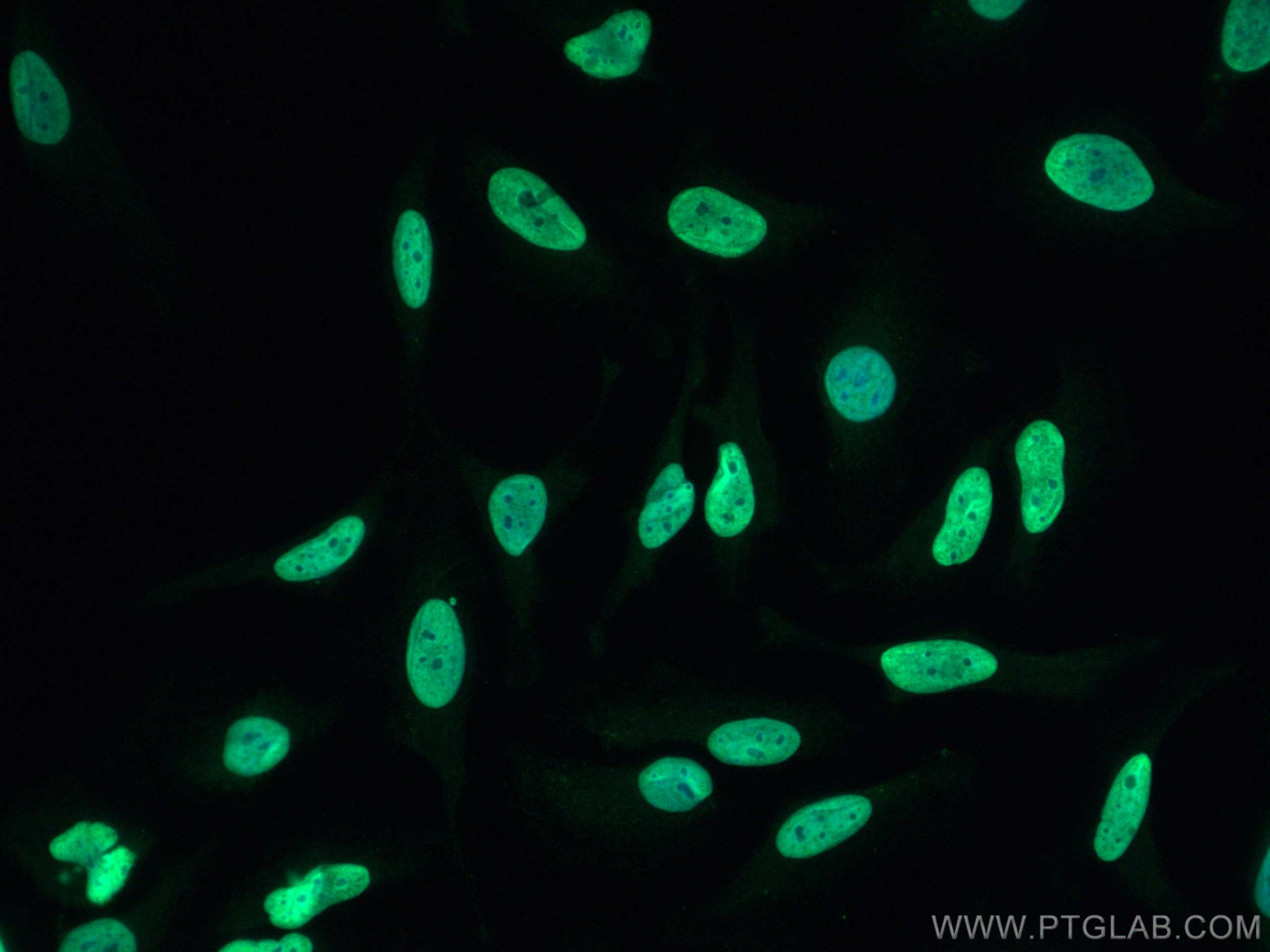 Immunofluorescence (IF) / fluorescent staining of HeLa cells using Histone H3 Polyclonal antibody (17168-1-AP)