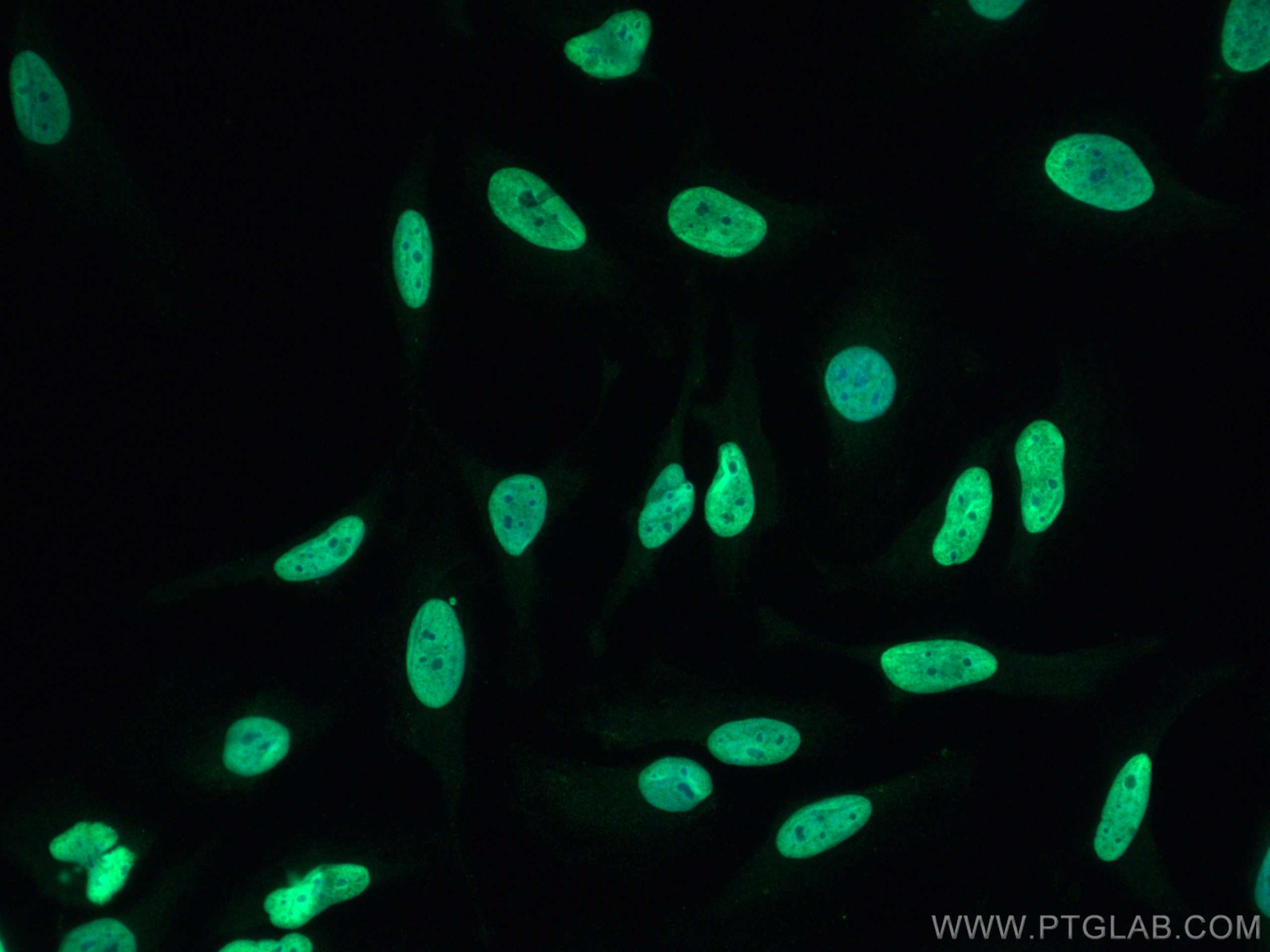 IF Staining of HeLa using 17168-1-AP