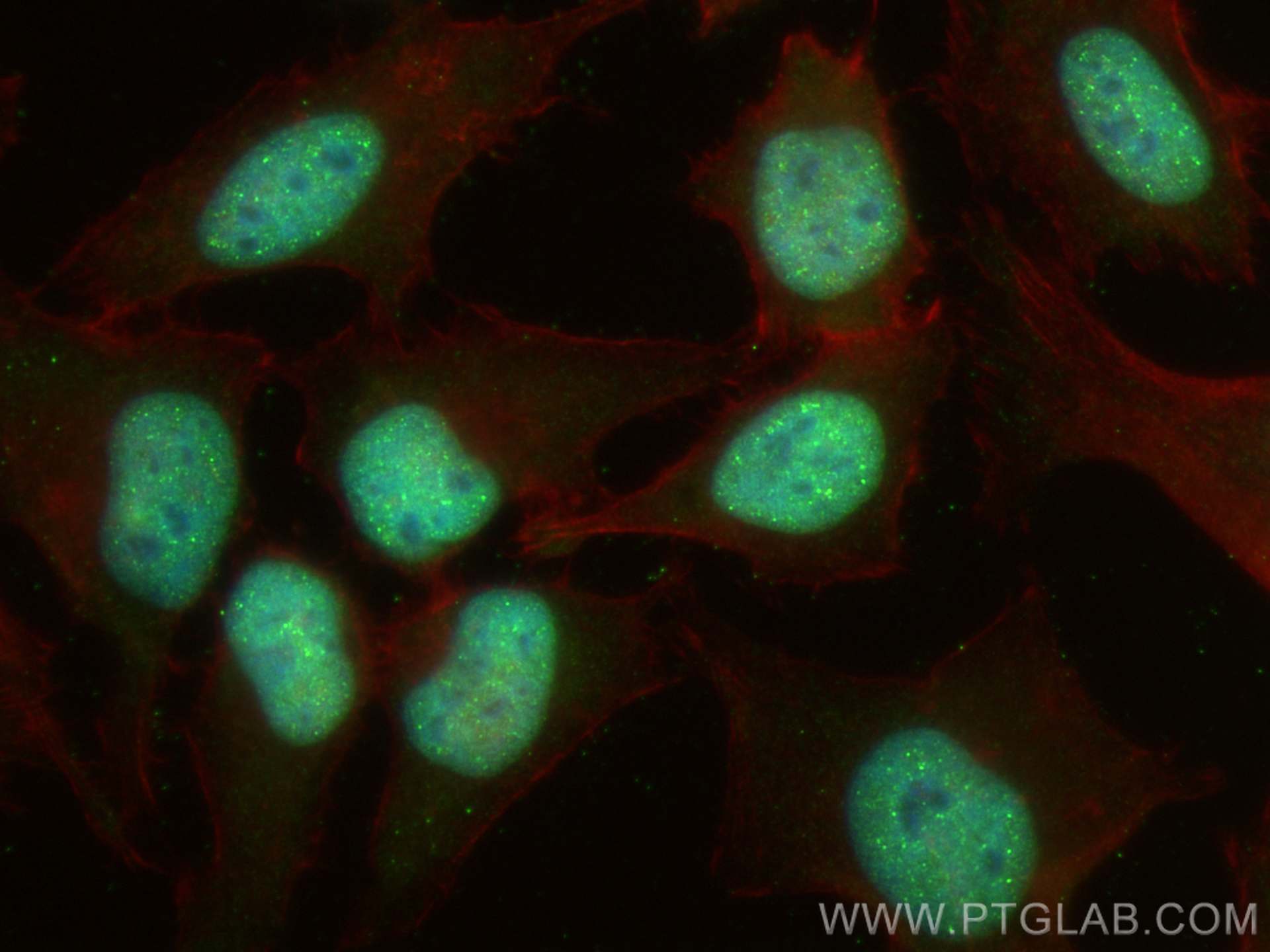 Immunofluorescence (IF) / fluorescent staining of HeLa cells using Histone-H3 Polyclonal antibody (17168-1-AP)