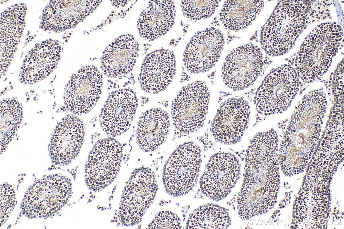 IHC staining of mouse testis using 29200-1-AP