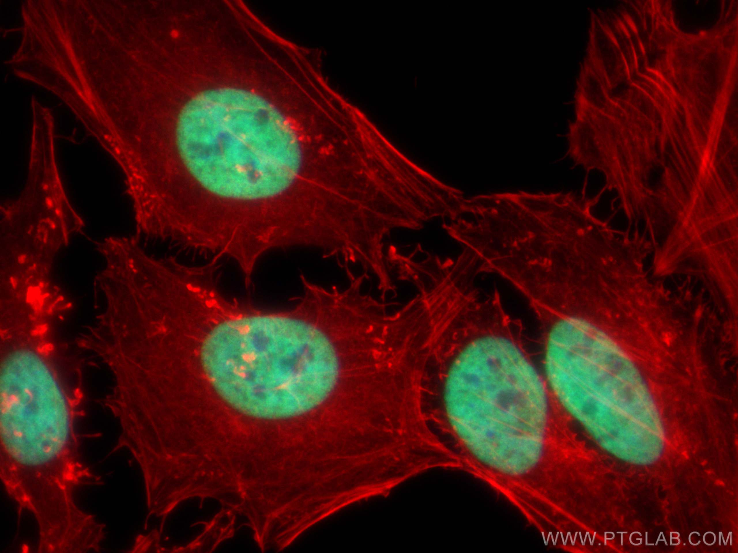 Immunofluorescence (IF) / fluorescent staining of HeLa cells using Histone H3 Monoclonal antibody (68345-1-Ig)