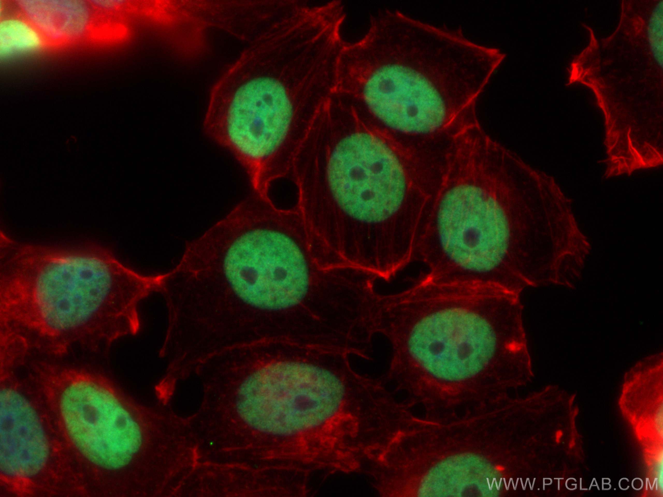 Immunofluorescence (IF) / fluorescent staining of MCF-7 cells using Histone H3 Monoclonal antibody (68345-1-Ig)