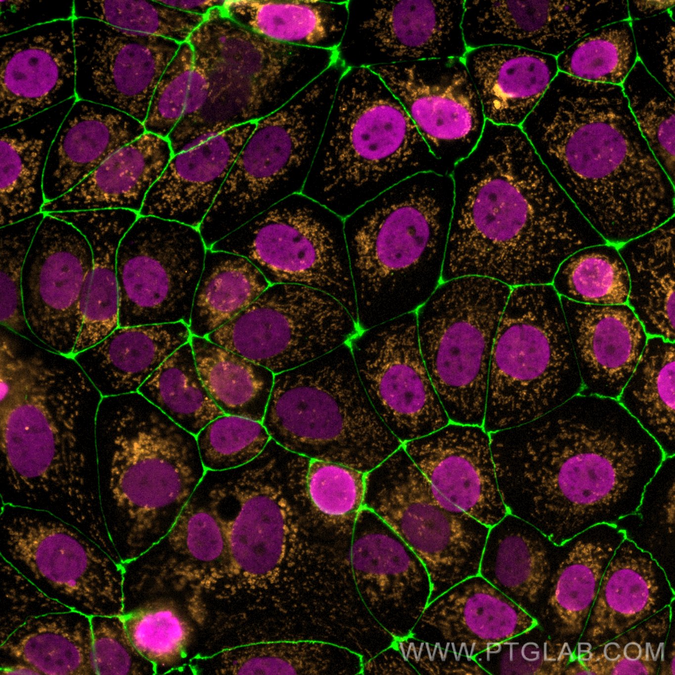 Immunofluorescence (IF) / fluorescent staining of MCF-7 cells using Histone H3 Monoclonal antibody (68345-1-Ig)