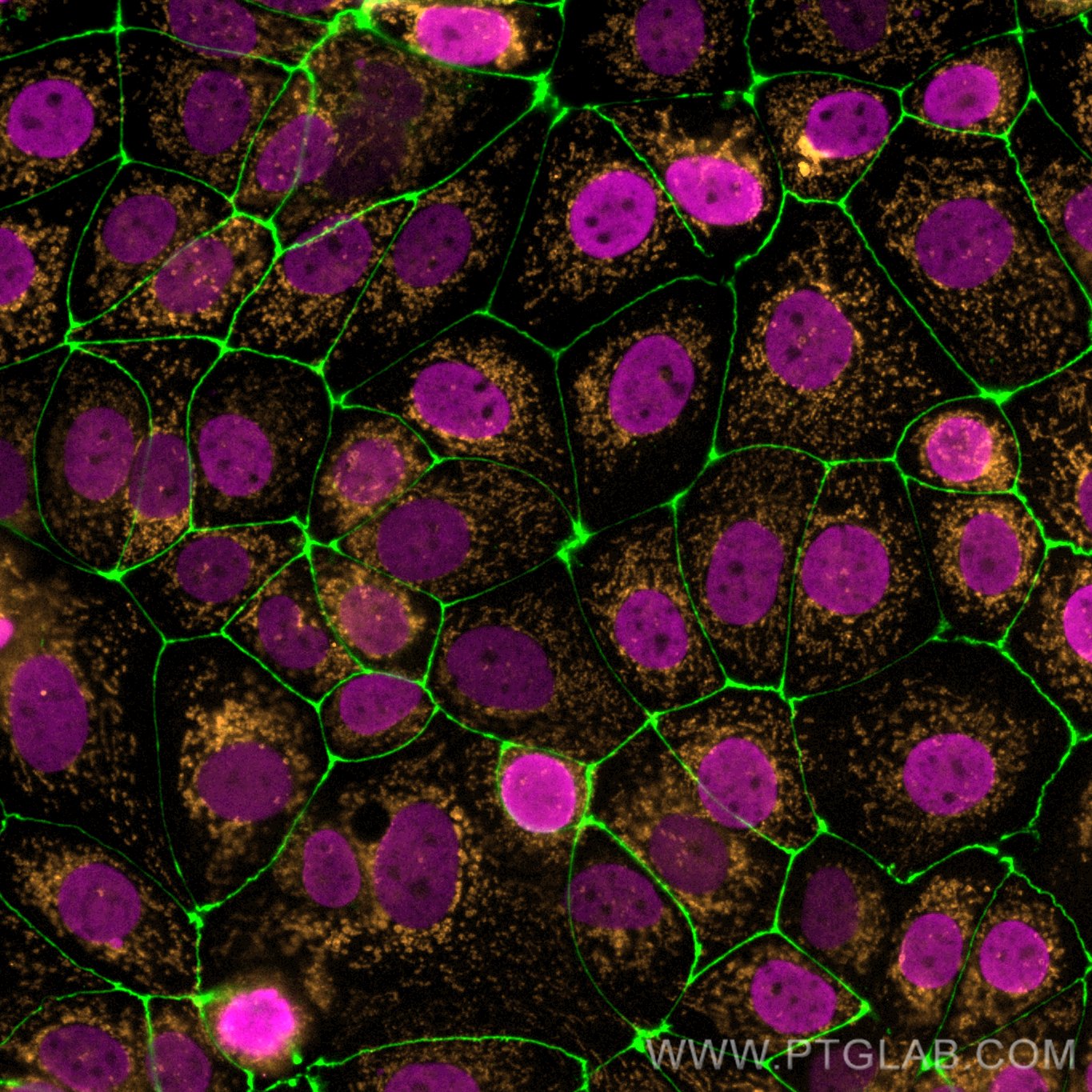 IF Staining of MCF-7 using 68345-1-Ig