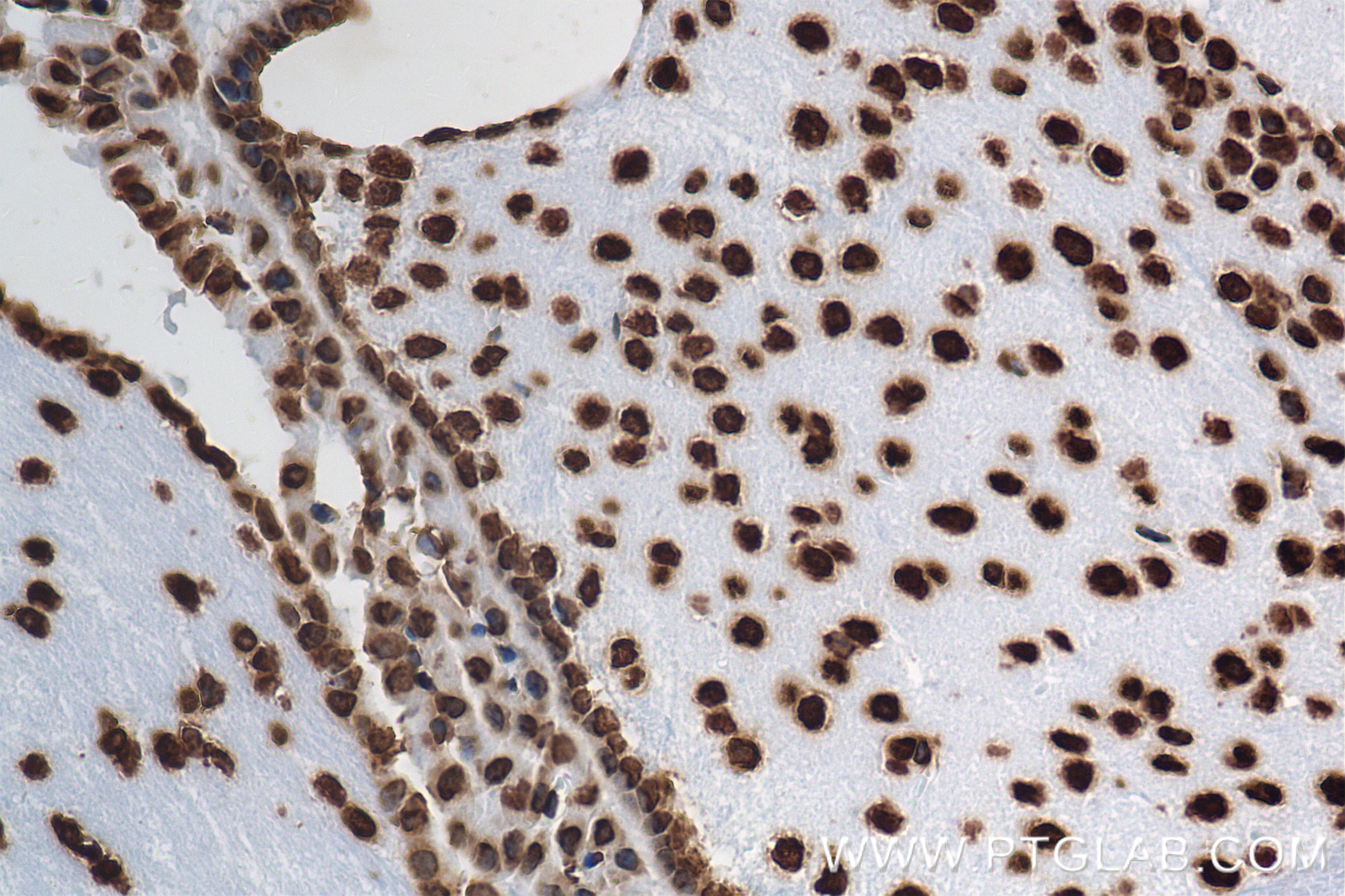 Immunohistochemistry (IHC) staining of mouse brain tissue using Histone H3 Recombinant antibody, PBS Only (81984-2-PBS)