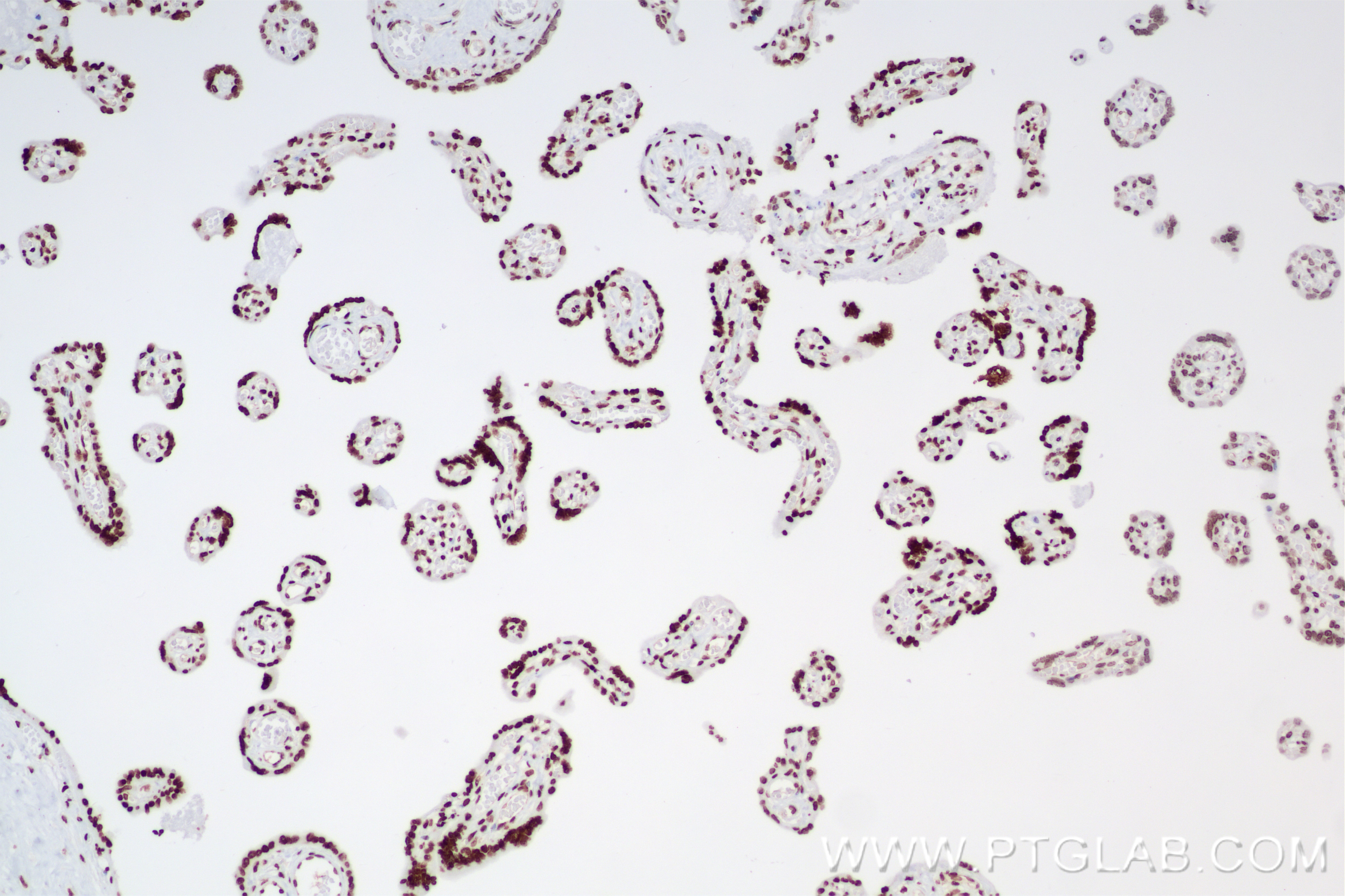 Immunohistochemistry (IHC) staining of human placenta tissue using Histone H3 Recombinant antibody (82807-2-RR)