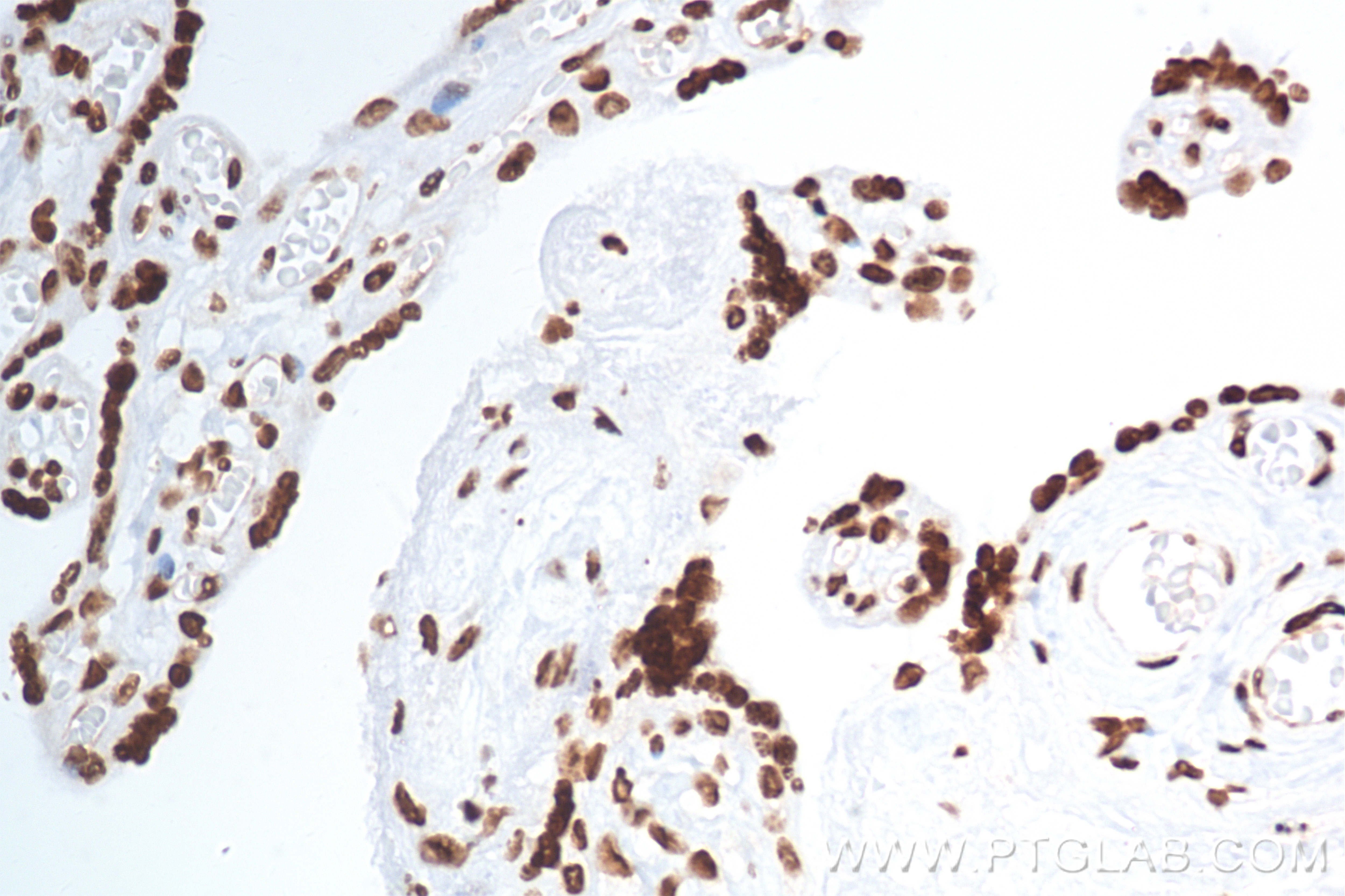 Immunohistochemistry (IHC) staining of human placenta tissue using Histone H3 Recombinant antibody (82807-2-RR)