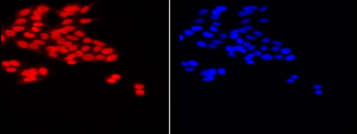 Histone H3 acetyl Lys18 pAb tested by immunofluorescence. Left: HeLa cells stained with Histone H3 acetyl Lys18 pAb. Right: DAPI stain.
