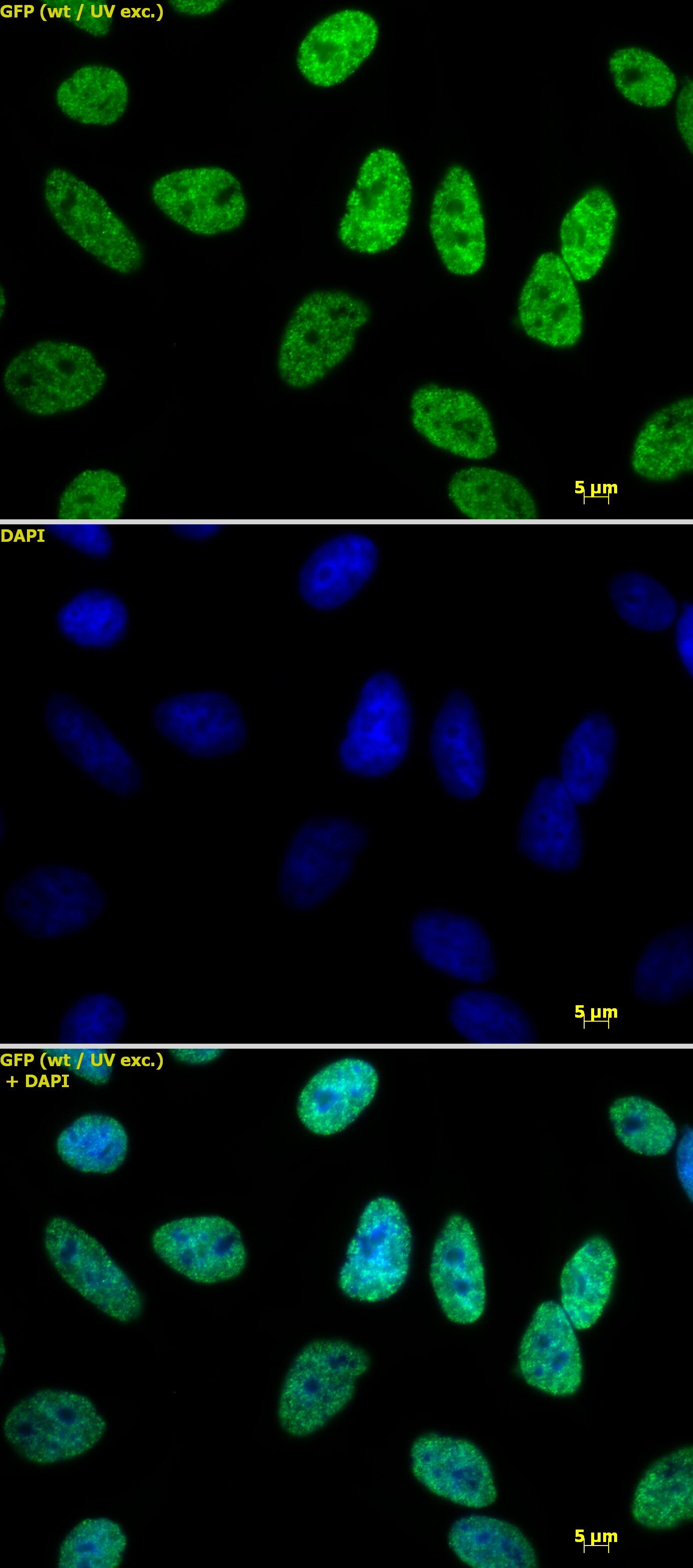 Histone H3 acetyl Lys18 antibody tested by immunofluorescence. Detection of Histone H3 acetyl Lys18 by immunofluorescence. HeLa cells were stained with Histone H3 acetyl Lys18 antibody at a dilution of 1 ug/ml. Top panel: Histone H3 acetyl Lys18 antibody staining. Middle panel: DAPI. Bottom panel: merge.