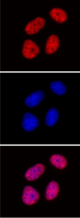 Histone H3 di/trimethyl Lys27 antibody (mAb) tested by immunofluorescence. Top: HeLa cells stained with Histone H3 di/trimethyl Lys27 antibody (mAb) at 1:500 dilution (red). Middle: Same cells stained with DAPI (blue). Bottom: Both images merged. Staining was carried out using MAX Stain Immunofluorescence Tools.