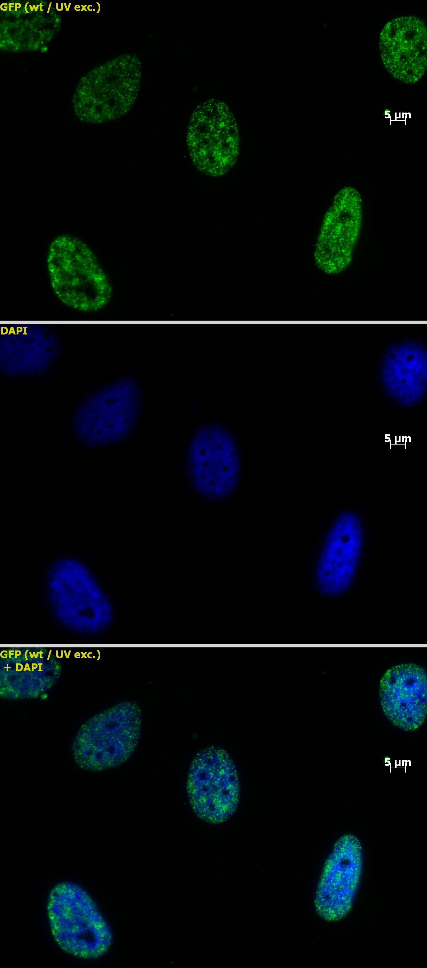 Histone H3K4me2 antibody (mAb) tested by immunofluorescence. Staining of HeLa cells with Histone H3 dimethyl Lys4 antibody (mAb) (1 ug/ml, top panel) and DAPI (middle panel), and a merge of both images (bottom panel).