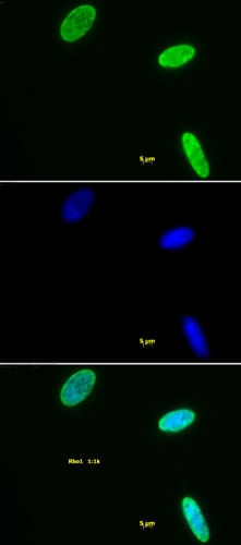 Histone H3K9me2 antibody tested by immunofluorescence. Staining of HeLa cells with Histone H3K9me2 antibody (1:1,000 dilution, top panel) and DAPI (middle panel), and a merge of both images (bottom panel). Histone H3K9me2 antibody tested by immunofluorescence. Staining of HeLa cells with Histone H3K9me2 antibody (1:1,000 dilution, top panel) and DAPI (middle panel), and a merge of both images (bottom panel).