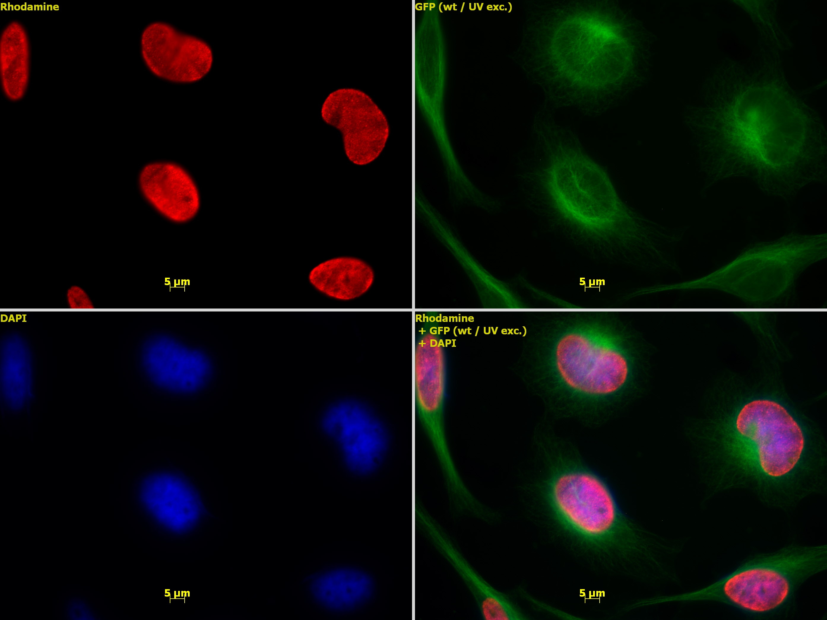 Histone H3 dimethyl Lys9 antibody tested by immunofluorescence. Top left: HeLa cells stained with Histone H3 dimethyl Lys9 antibody (1:1,000). Top right: Same cells stained with alpha Tubulin mAb (Clone 5-B-1-2). Bottom left: Same cells stained with DAPI. Bottom right: Merge of all 3 images.