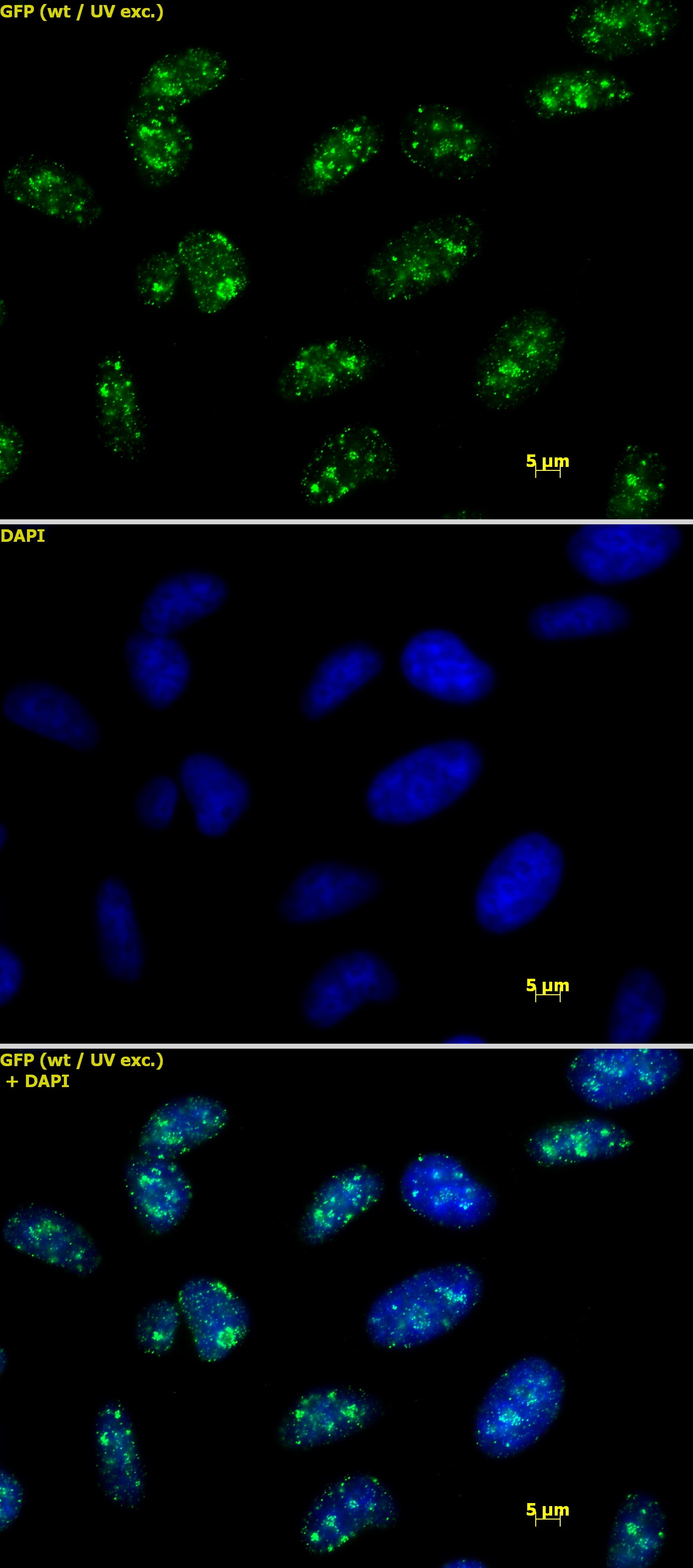 Histone H3 trimethyl Lys9 antibody tested by immunofluorescence. Detection of Histone H3 trimethyl Lys9 by immunofluorescence. HeLa cells were stained with Histone H3 trimethyl Lys9 antibody at a dilution of 1 ug/ml. Top panel: Histone H3 trimethyl Lys9 antibody staining. Middle panel: DAPI. Bottom panel: merge.